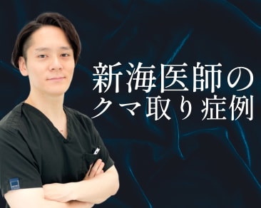 【SBC水戸院】クマ取り施術なら『SBC水戸院の新海医師』にお任せください！